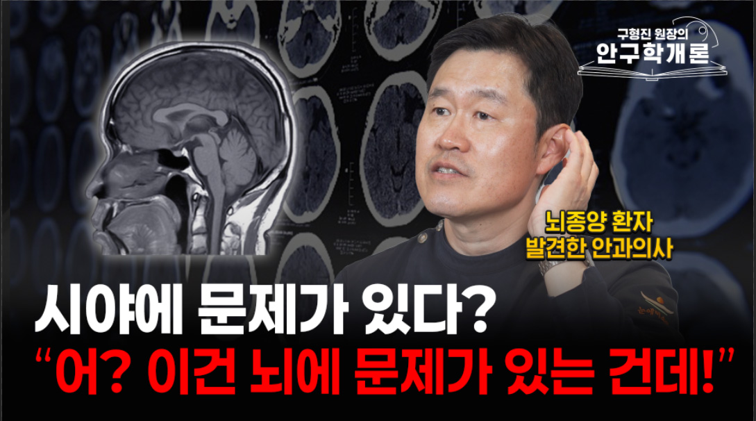 [안구학개론] 눈 검사로 인생을 바꾼 충격적인 결과, 우리가 80가지 검사를 진행하는 이유