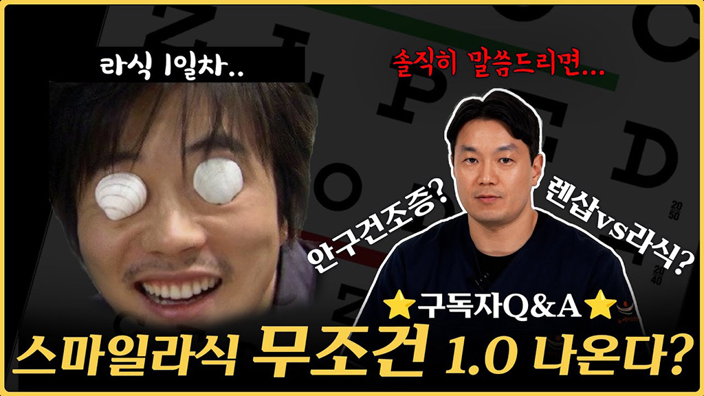 스마일라식 6년차 안과의사 Q&A